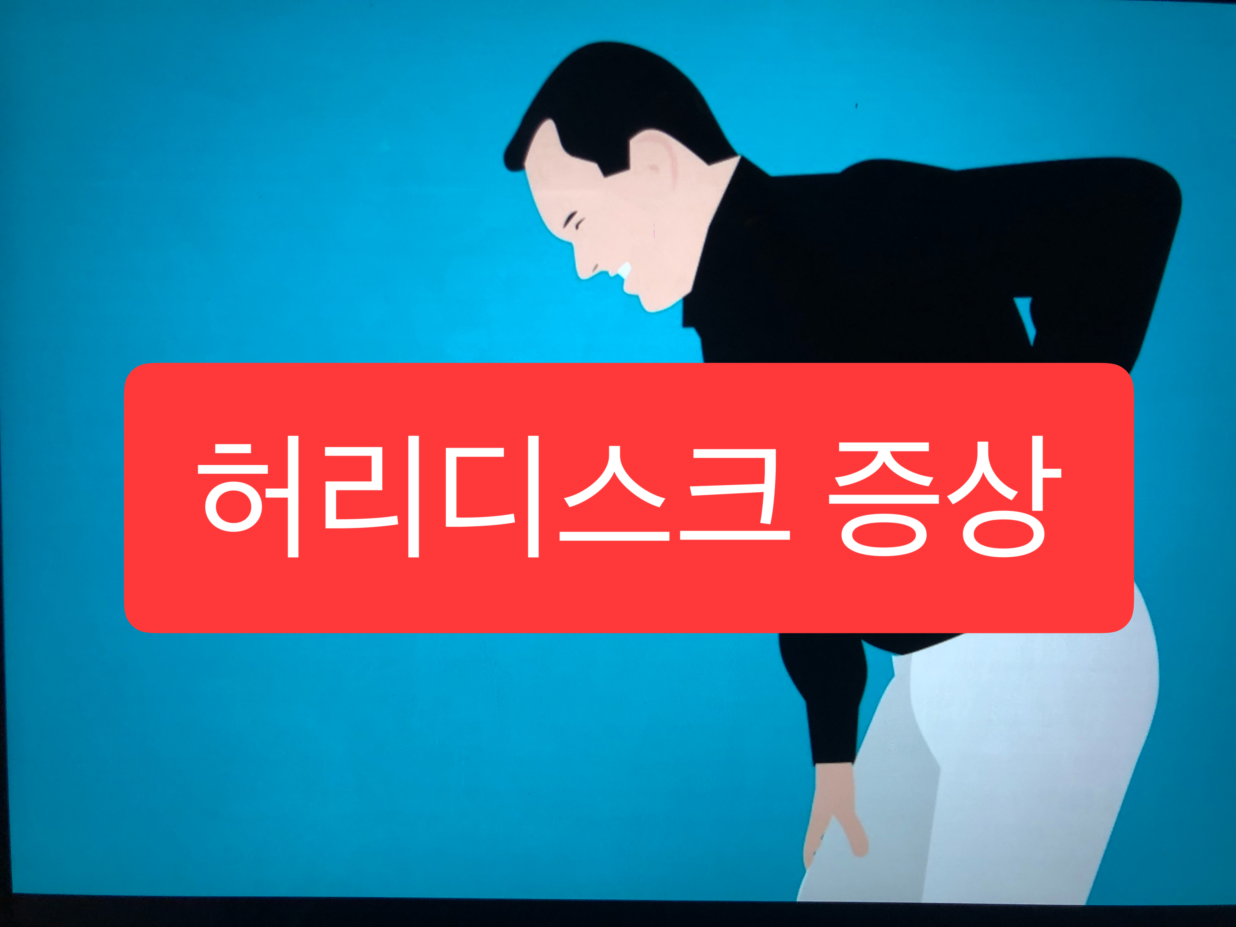  허리디스크 증상 5가지