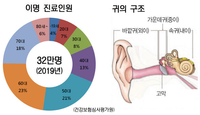 이명 연령별 환자분포