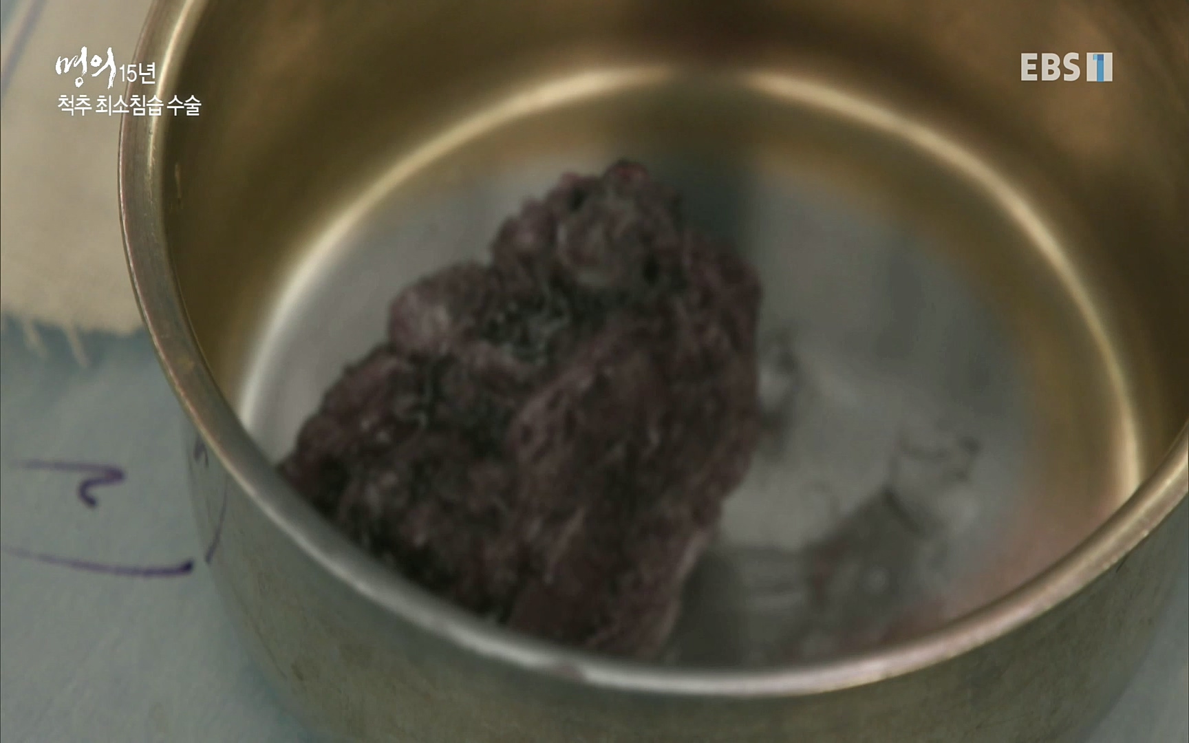 EBS 명의 헬스케어 - TV - 교육의 중심 EBS명의 15년 - 허리통증을 잡아라!.mp4_20220805_210310.493.jpg