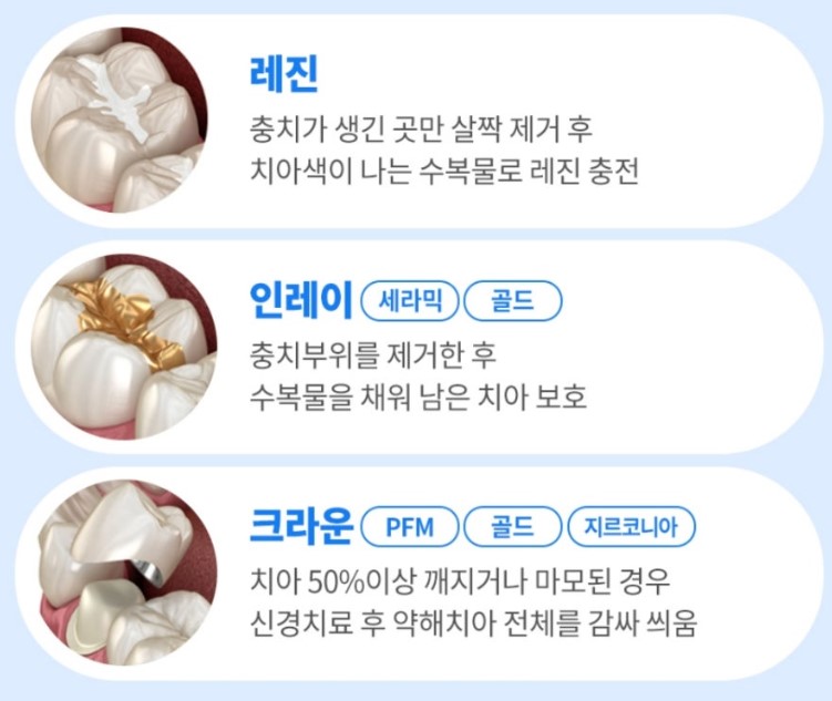 레진, 인레이, 크라운 치료 및 가격 안내