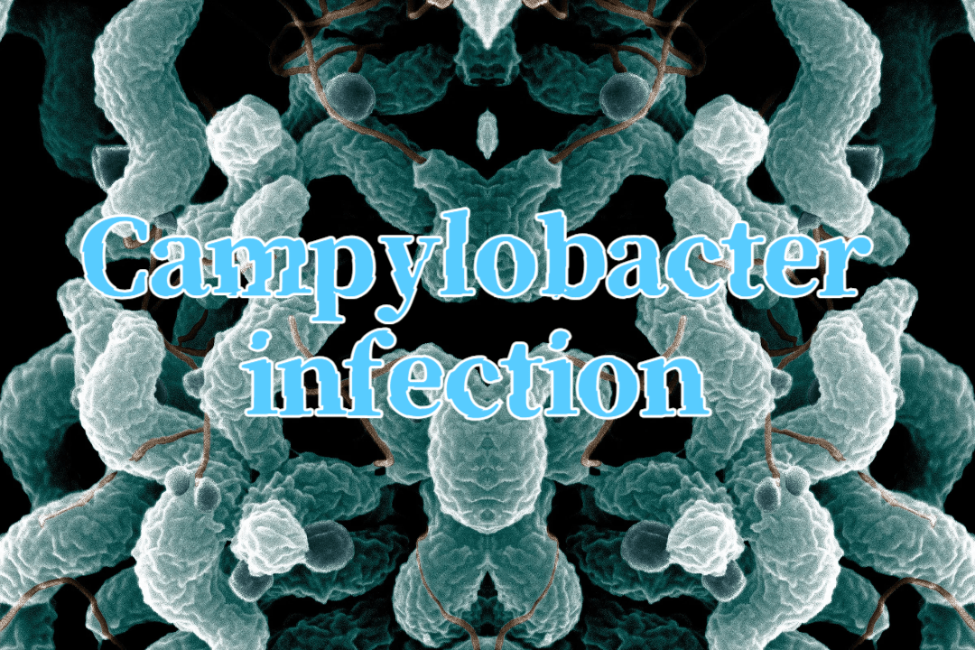 Campylobacter infection