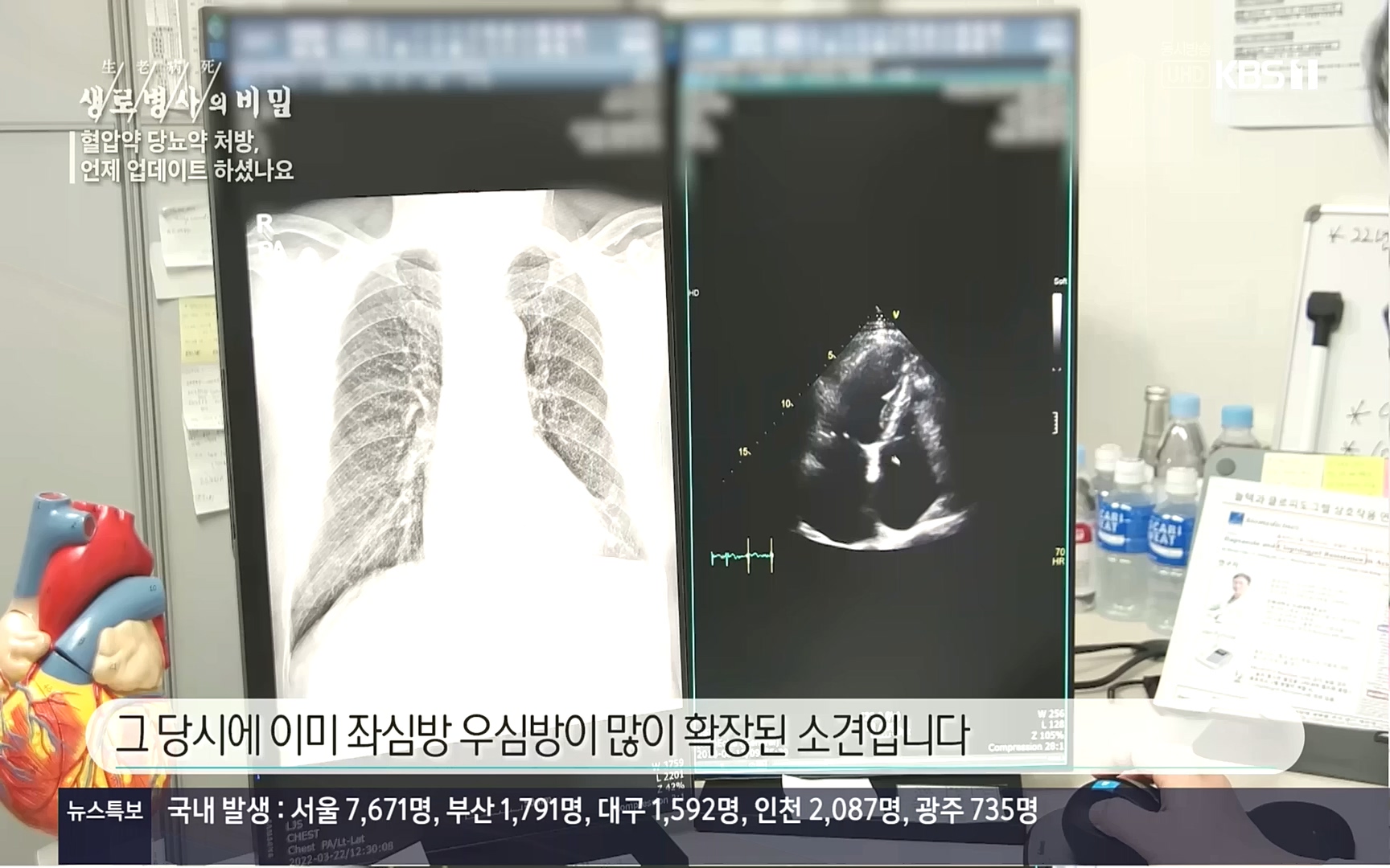 생로병사의 비밀.E838.221005p.H264-F1RST.mp4_20221008_182155.203.jpg