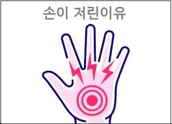 손이 저린이유