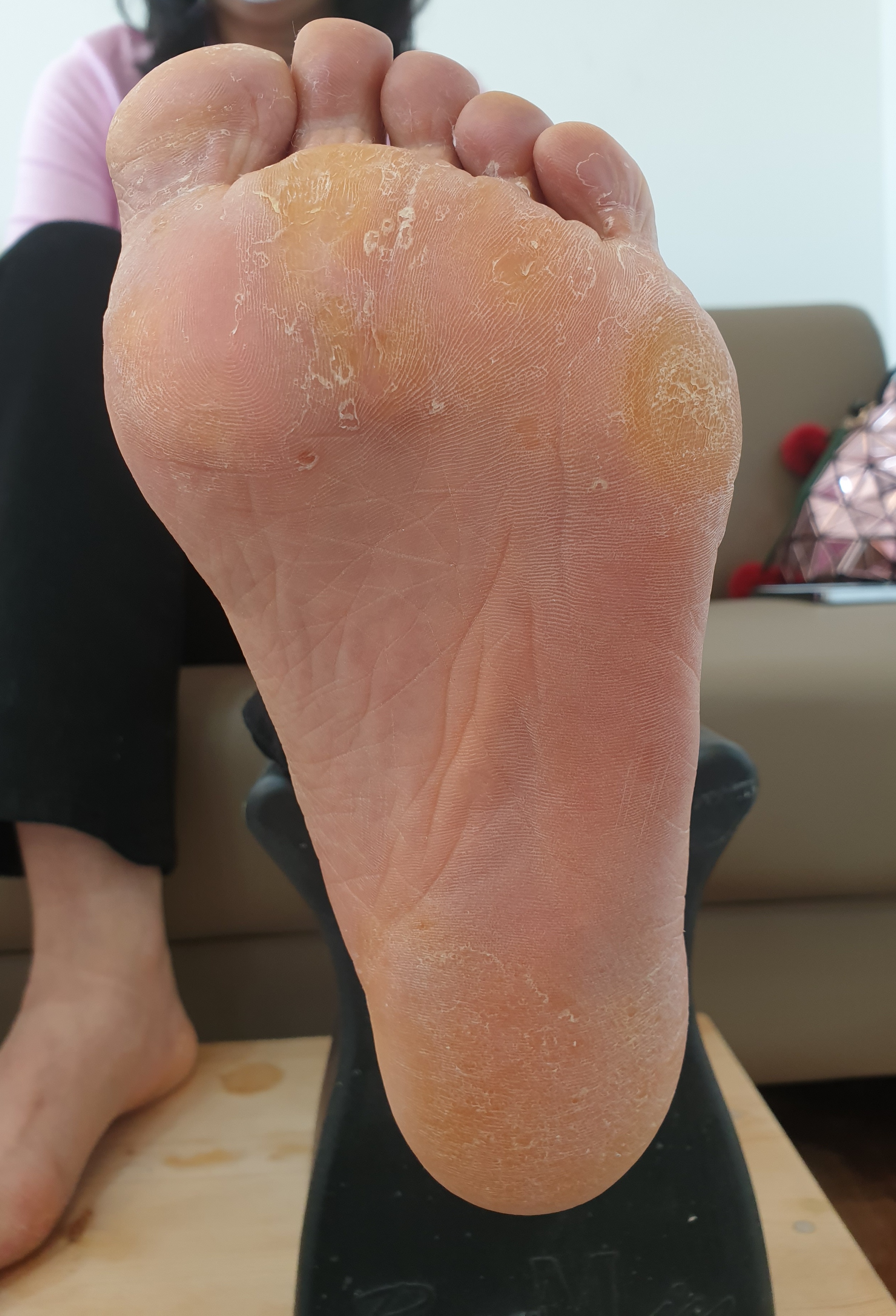 로제네일 이미지