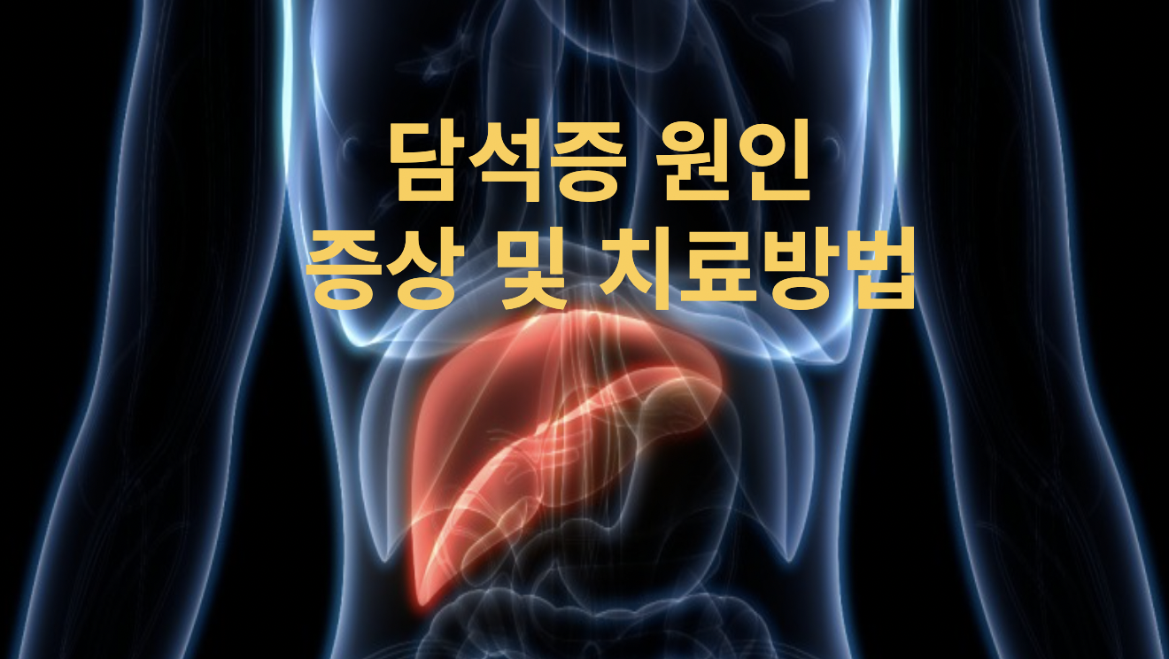  [건강정보] 담석증이란? 담석증 증상과 원인, 치료방법 살펴봐요