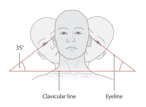 두부와 경추의 측굴의 기준선과 측정방법을 보여주는 그림