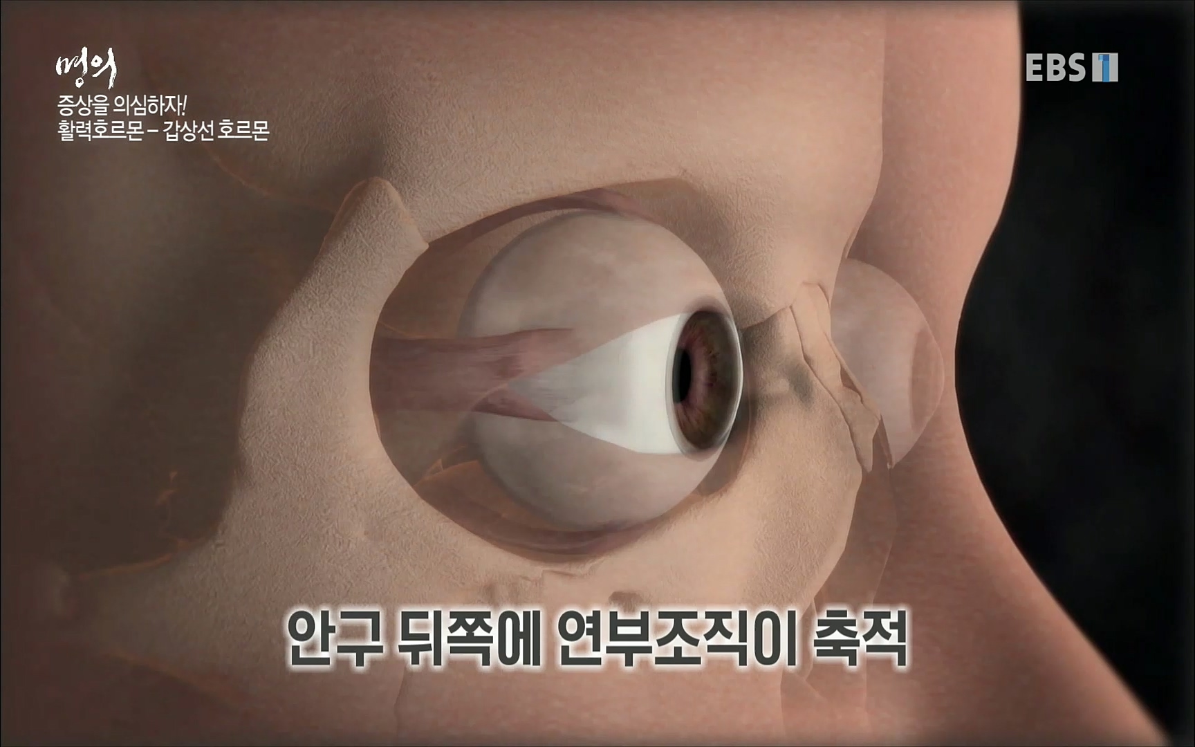 EBS 명의 헬스케어 - TV - 교육의 중심 EBS내 몸을 지배하는 7가지 호르몬 2부, 증상을 의심하자!.mp4_20220711_200206.134.jpg