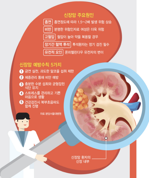 신장암 초기증상