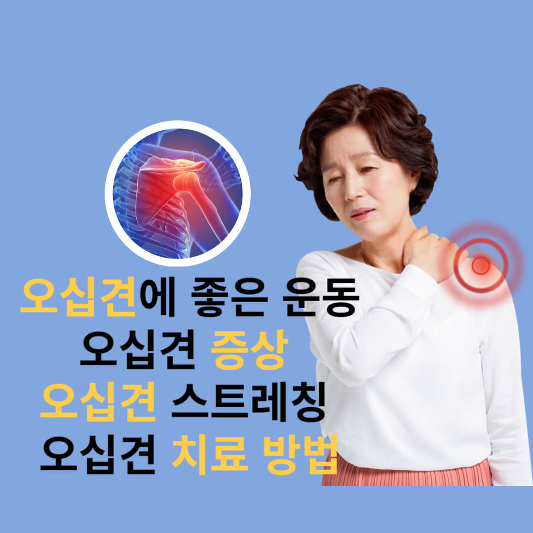  오십견 에 좋은 운동과 증상 스트레칭 치료 방법 알아보기