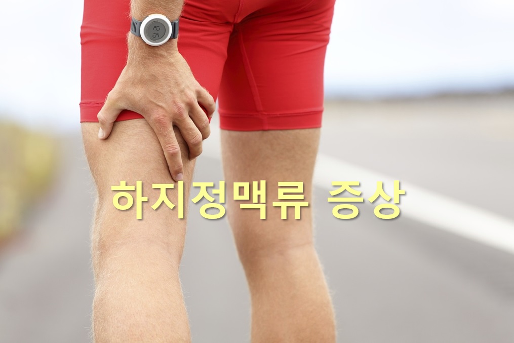  하지정맥류 증상과 하지정맥류 수술비용 실비보험 청구