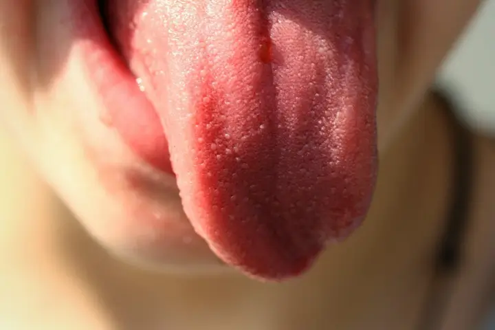 혀바닥