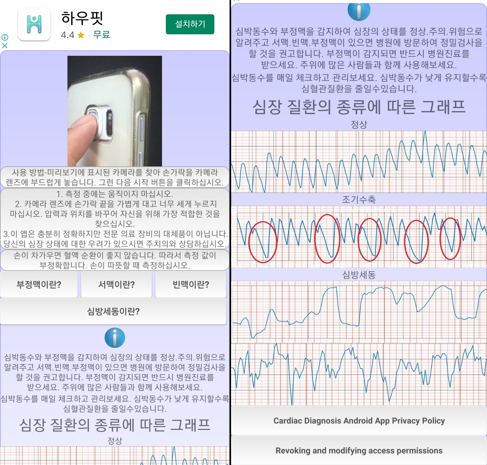 심전도, 심박수 측정 어플 기능