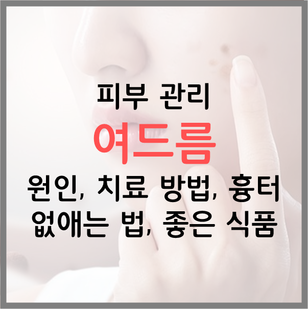  여드름 발생 원인, 치료 방법, 흉터 없애는 법, 좋은 식단 총 정리