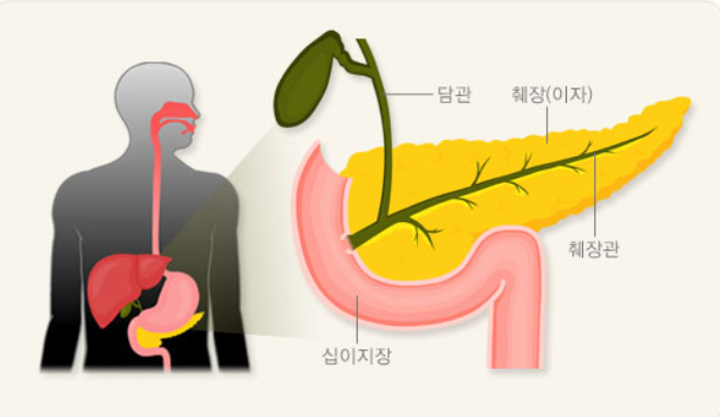 췌장암 치료 과정