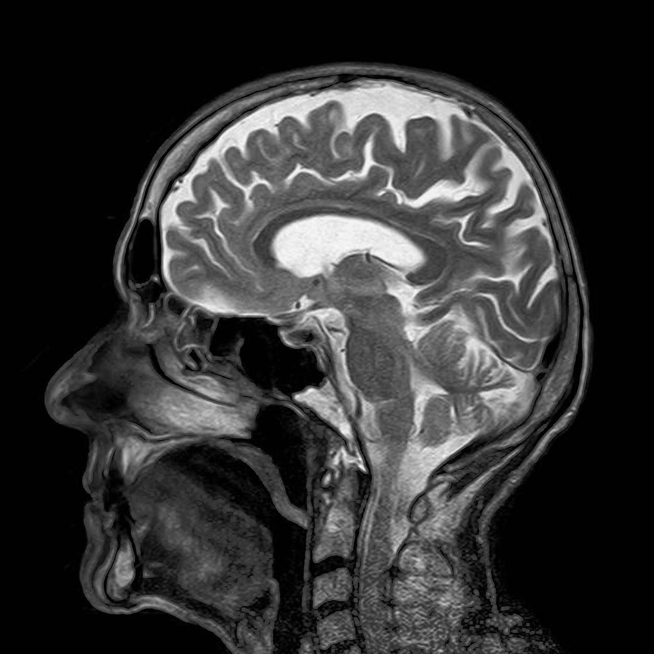 뇌영상검사 (MRI)