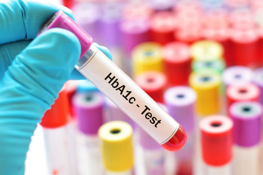 HbA1c 검사 당화혈색소 정상치