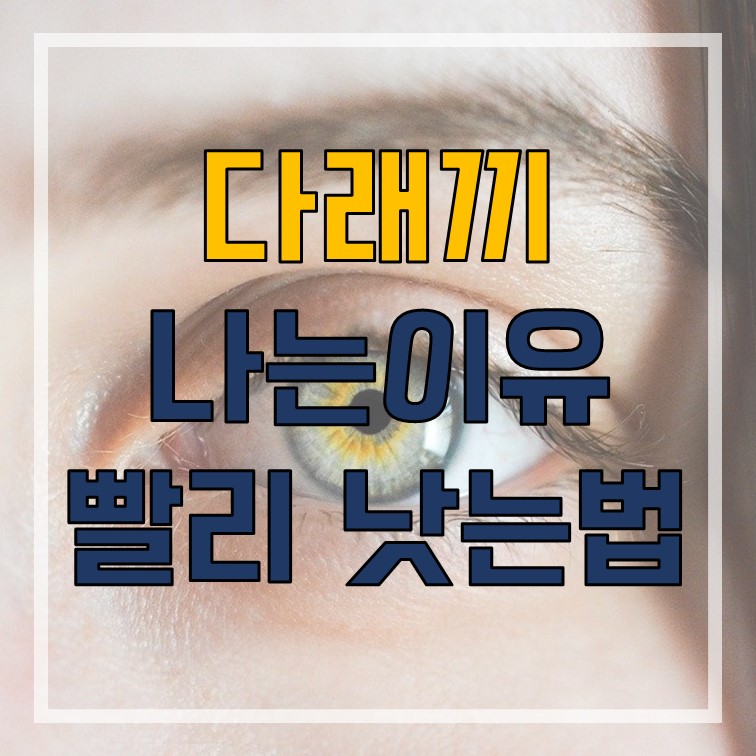  다래끼 나는 이유 다래끼 빨리 낫는법 전염 알아보기