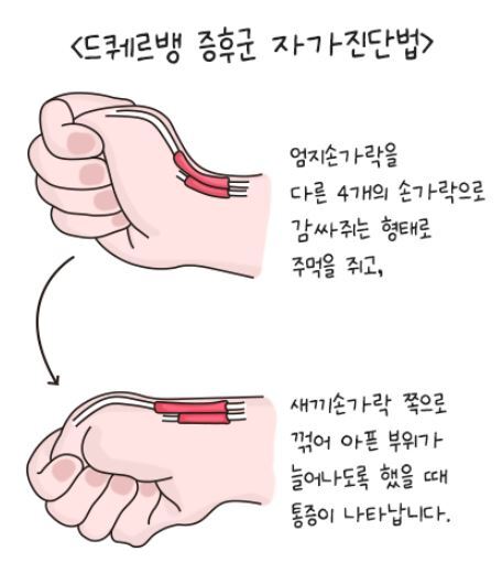 핀켈스테인테스트