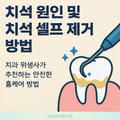 치석 원인 및 치석 셀프 제거 방법 썸네일