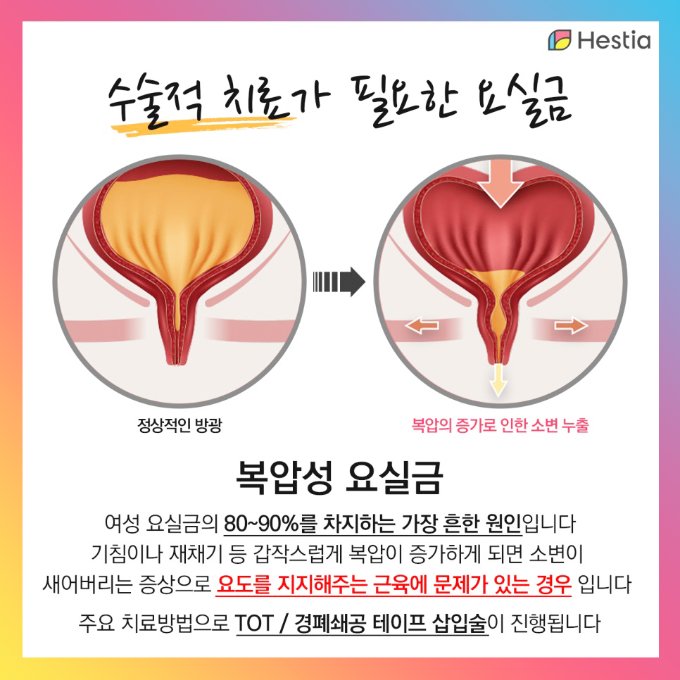 복압성요실금