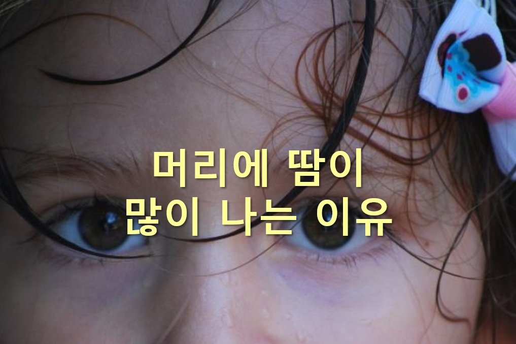  머리에 땀이 많이 나는 이유와 머리에 열이 많은 사람