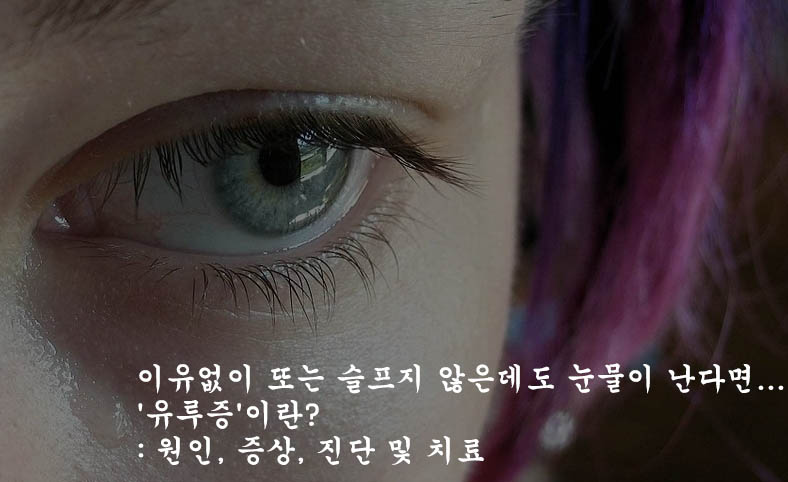  이유없이 또는 슬프지 않은데도 눈물이 난다면... '유루증'이란?: 원인, 증상, 진단 및 치료