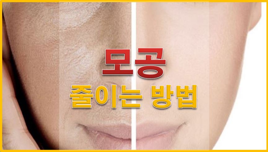 모공줄이는레이저종류 이것으로