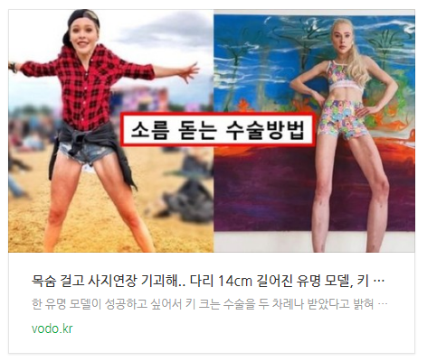  [저녁뉴스]"목숨 걸고 사지연장 기괴해".. 다리 14cm 길어진 유명 모델, 키 크는 수술 비용은?