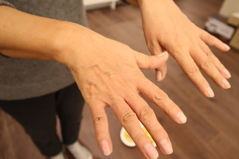손가락 마디 통증 증상&amp;#44; 손가락 마디가 아픈 이유와 완화법