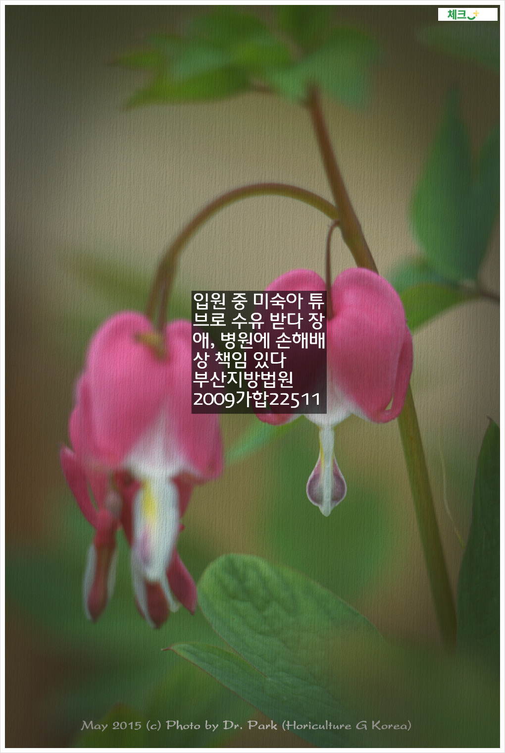 입원 중 미숙아 튜브로 수유 받다 장애, 병원에 손해배상 책임 있다