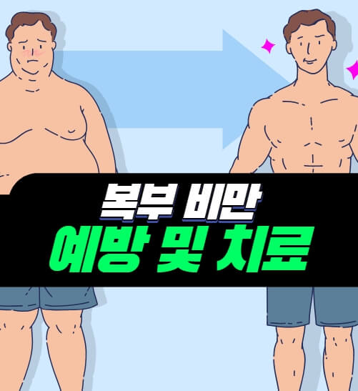  복부비만 예방 및 치료