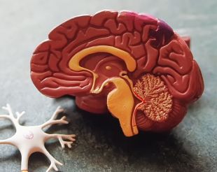 뇌경색