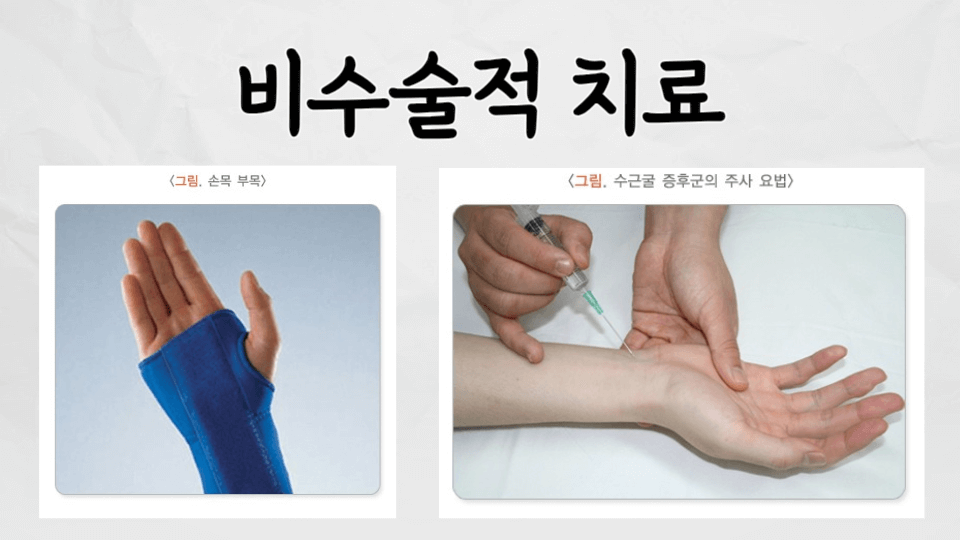 손목터널증후군 비수술적치료