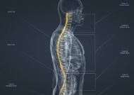 경추 디스크 증상