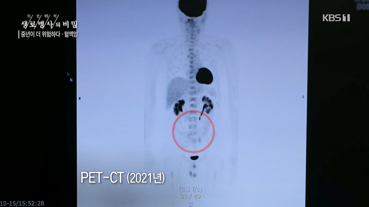 생로병사의 비밀.E868.230511p.H264-F1RST.mp4_20230511_201643.226.jpg