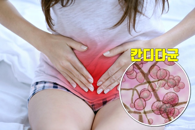 질염 원인 칸디다균 여성 트렁크팬티, 건강 팁줌 매일꿀정보