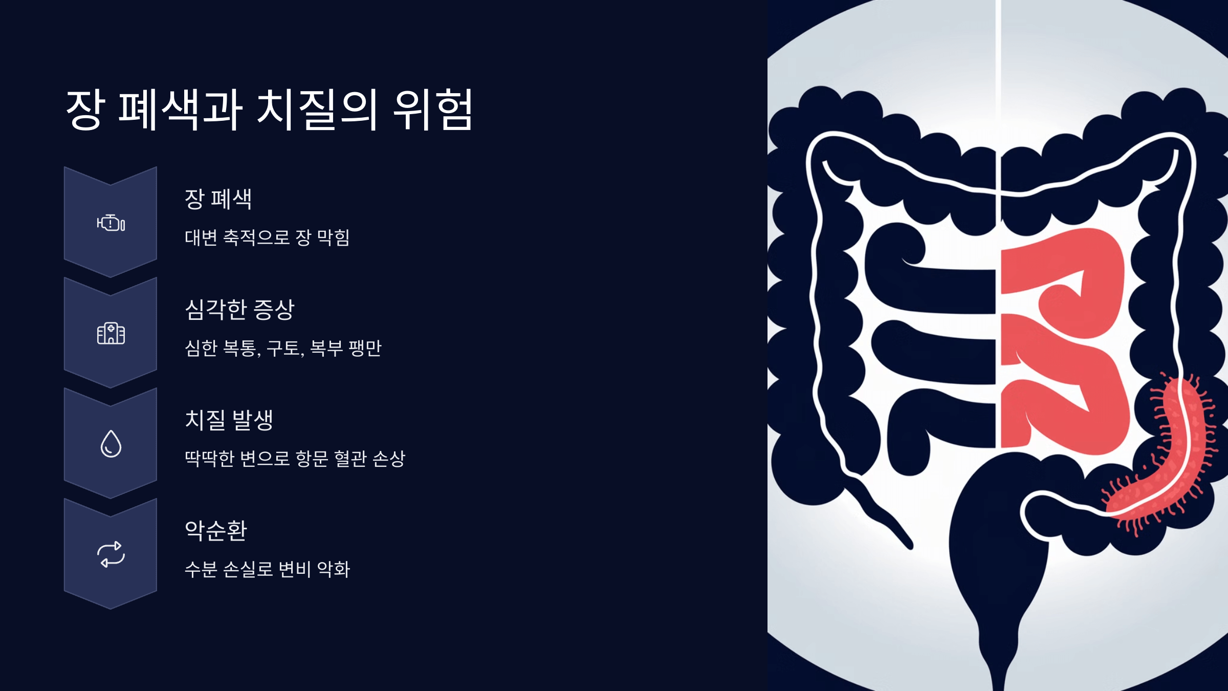 장 폐색과 치질