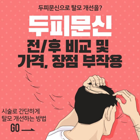  두피문신 전후 비교 및 가격과 장점 부작용