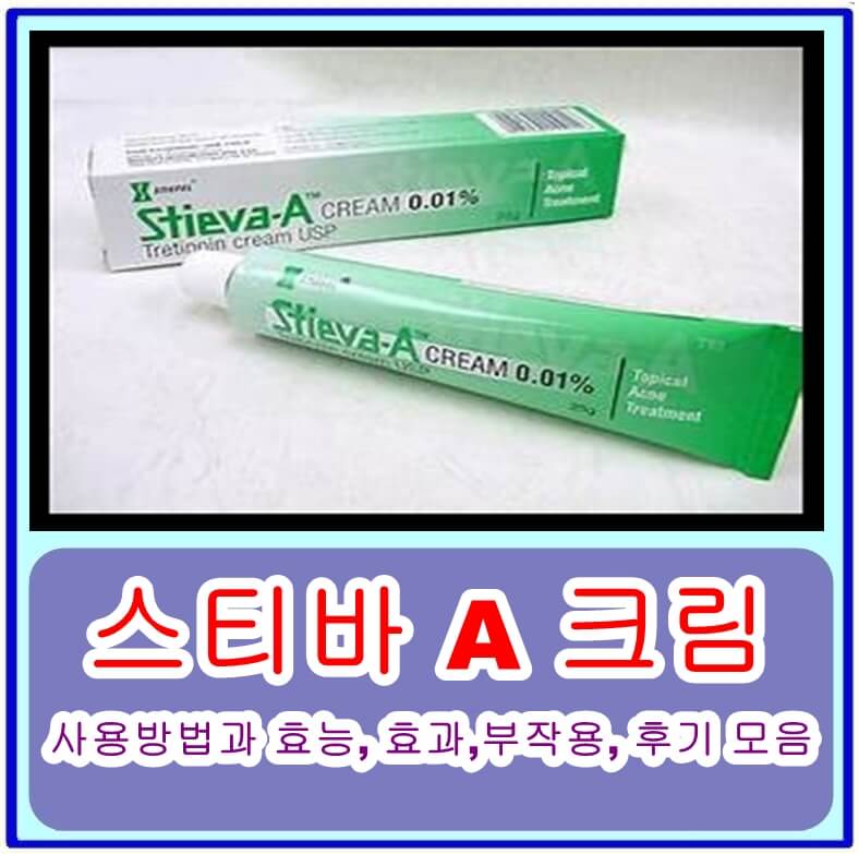  스티바 A 크림, 여드름과 잔주름에 효과적인 전문의약품! 사용방법과 효능, 효과,부작용, 후기 모음