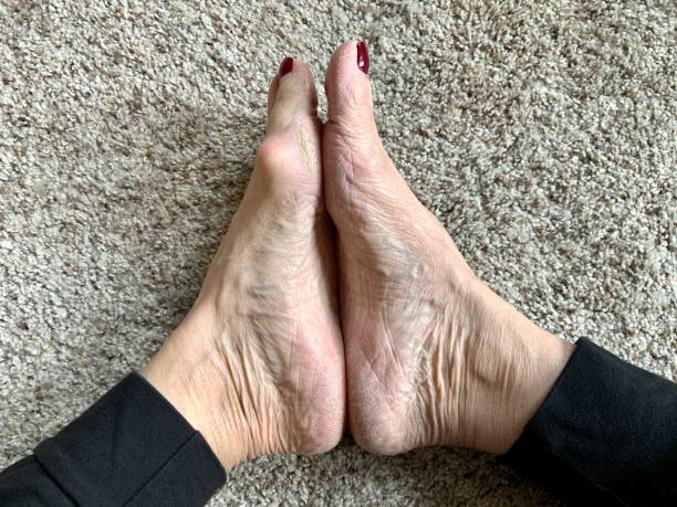 발바닥 통증의 원인 자세히 14