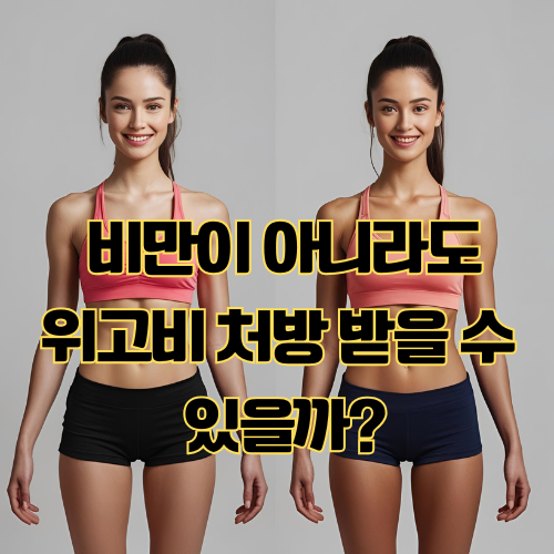 고도 비만 아니라도 위고비 처방 받을 수 있나? 부작용은?
