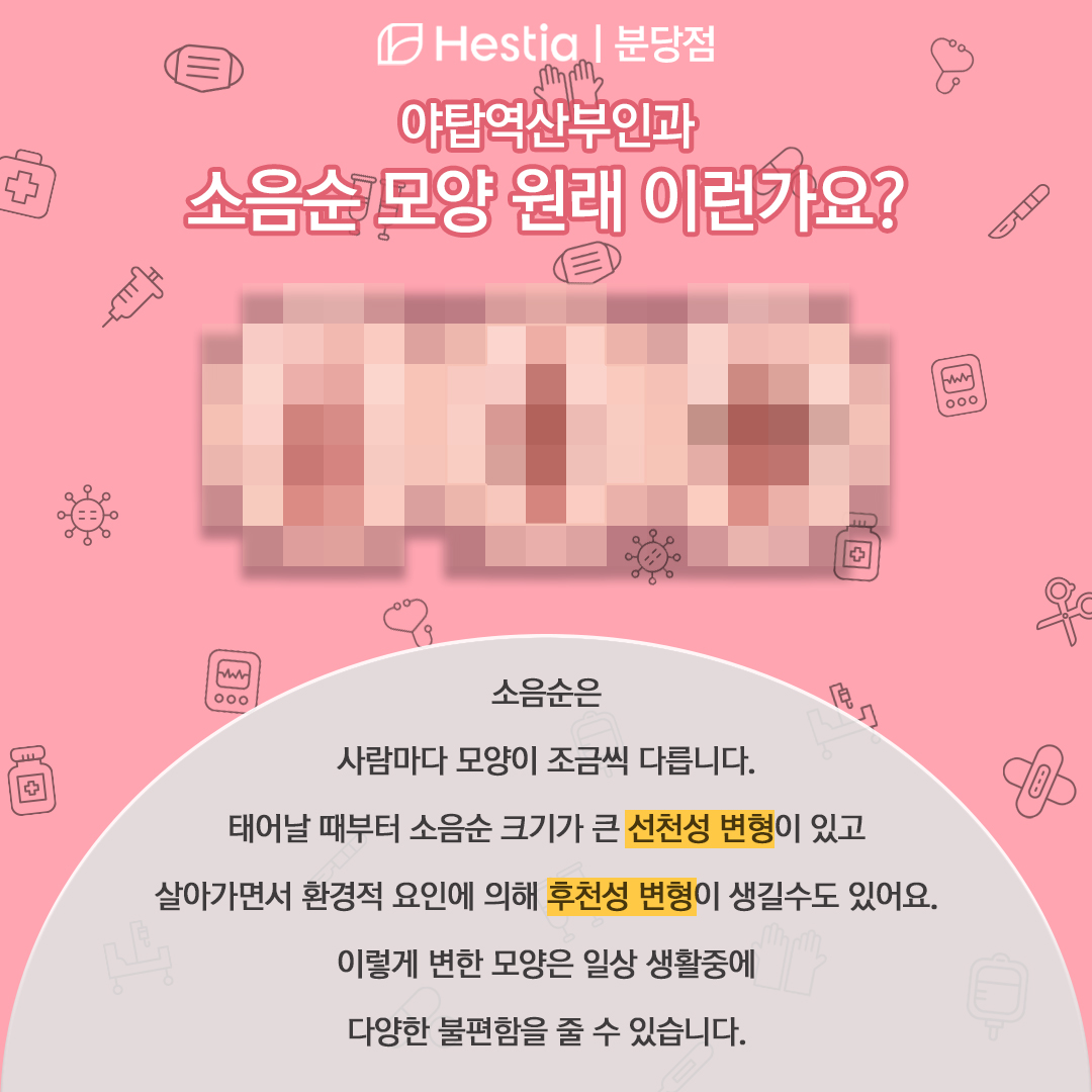 소음순 모양 야탑역산부인과 소음순 비대 원인 소음순 모양 나만 이런걸까?
