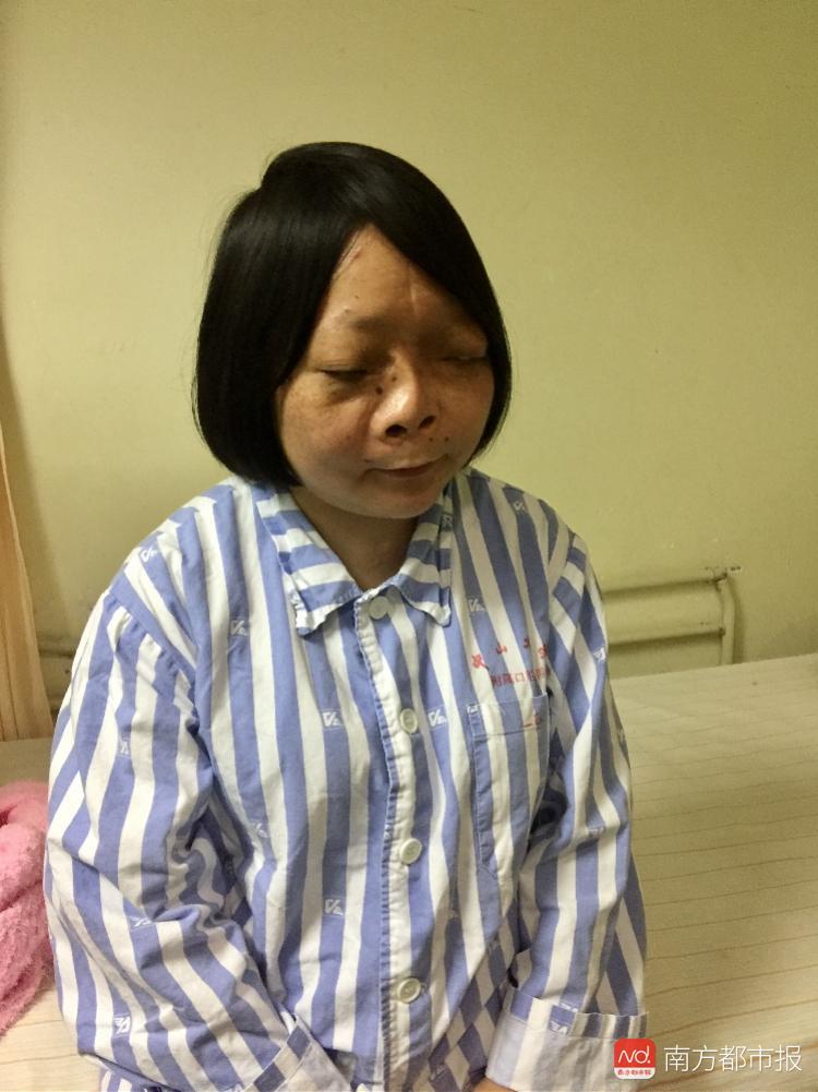 9살때부터 얼굴이 말처럼 변해버린 소녀에게 기적같은 일이 일어납니다