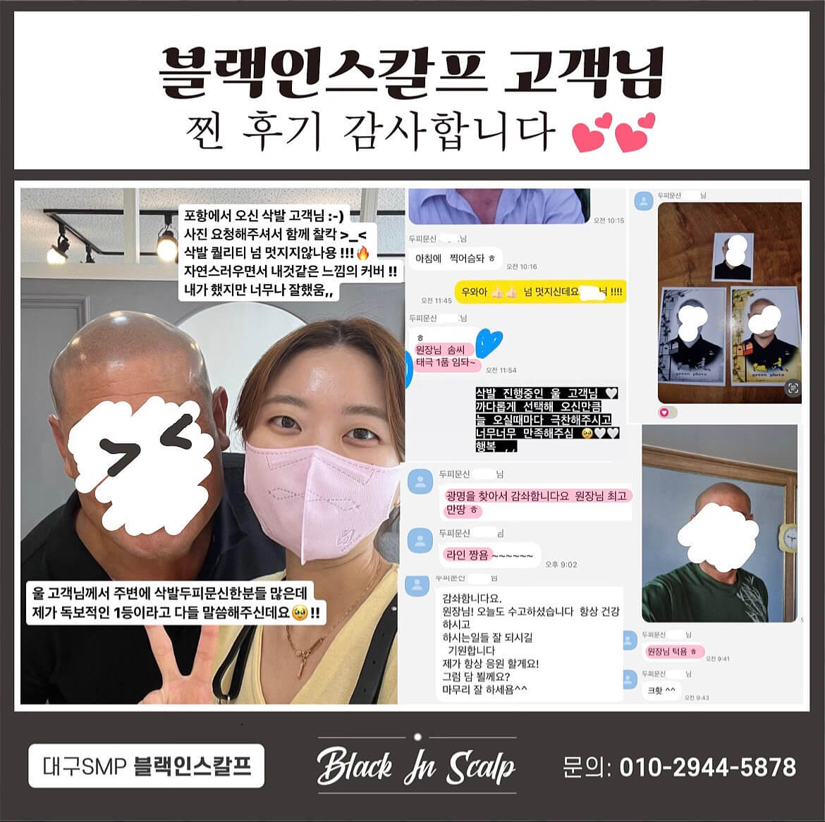 도트인스칼프 이미지