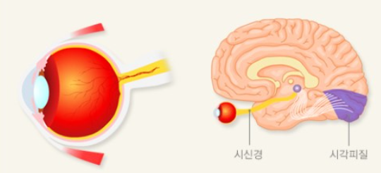  녹내장 원인 및 예방법