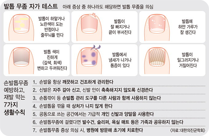 발톱무좀실비처리3