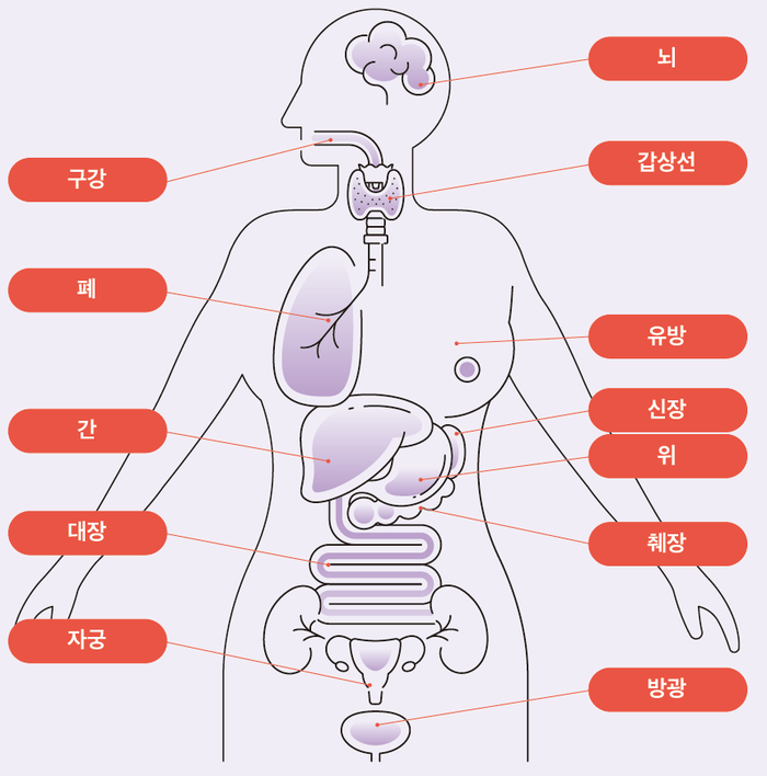 클리닉 ] 고주파온열암치료기 도입! [ 대전 암 면역 4