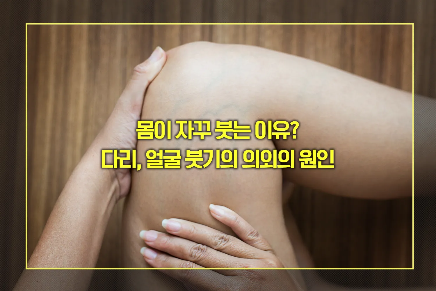 다리, 얼굴 붓기 원인