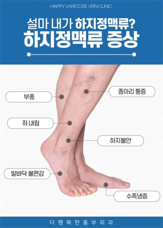 하지 정맥류 증상&amp;#44; 원인