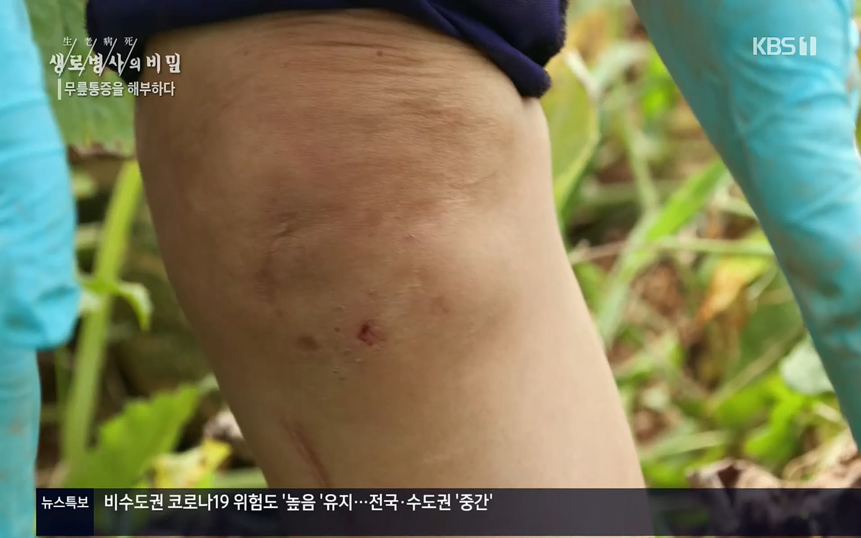 생로병사의 비밀.E834.220907p.H264-F1RST.mp4_20220908_210423.763.jpg